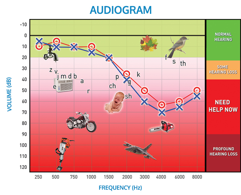 Find out how to read an audiogram