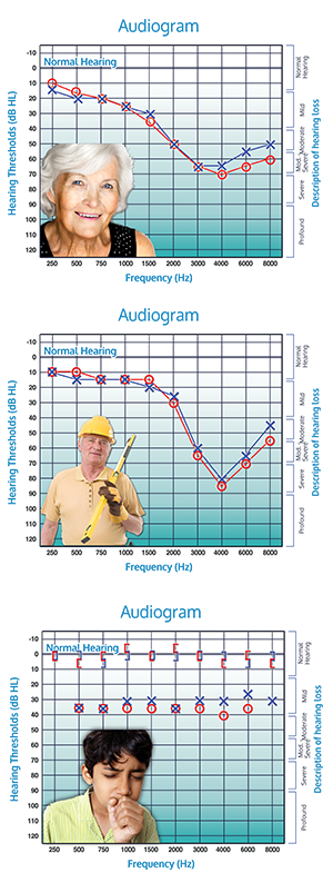 Here we can see the Audiograms of three people